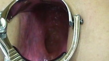 Elmer wife extreme anal speculum play