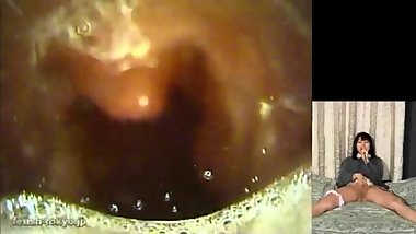 Japanese Mouth Endoscope