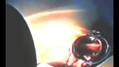 Zhangjiajing Nurses Taiwanese Taiwan Nurses(16